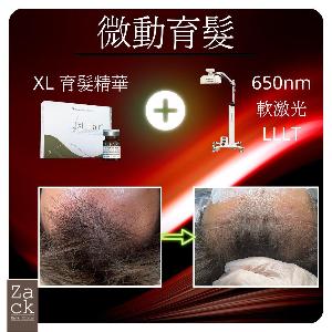 Micro微動育髮軟激光療程-體驗價